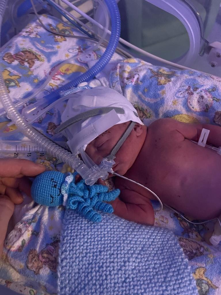 Premature babies in the UK 🇬🇧