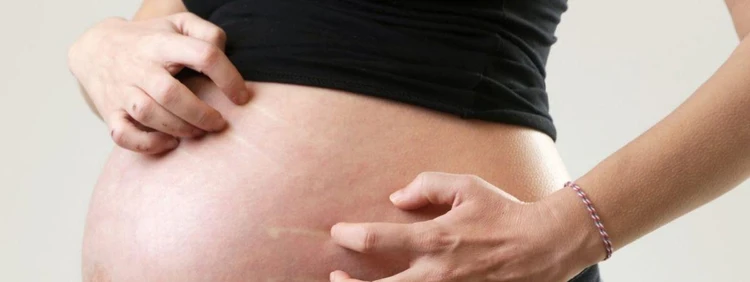 What is Cholestasis of Pregnancy?