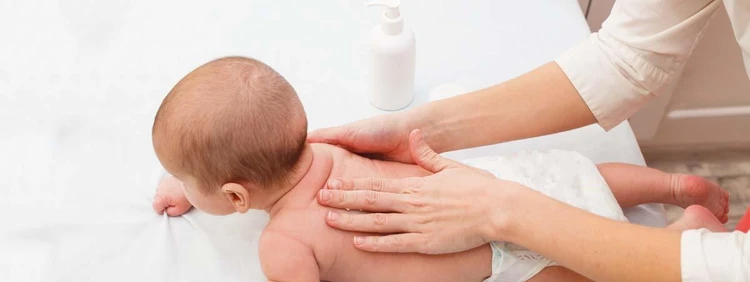 How to Treat Baby Eczema