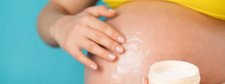 What Causes Stretch Marks?