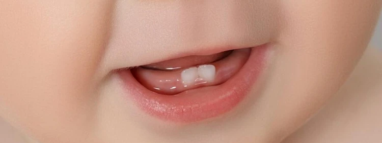 Baby’s Born With Teeth! How Rare Are Natal Teeth?