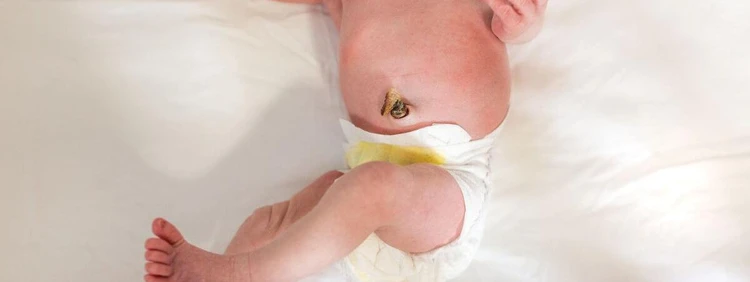 What to Know About Baby's Umbilical Cord Falling Off 