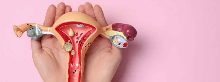 Does Uterus Shape Affect Fertility?