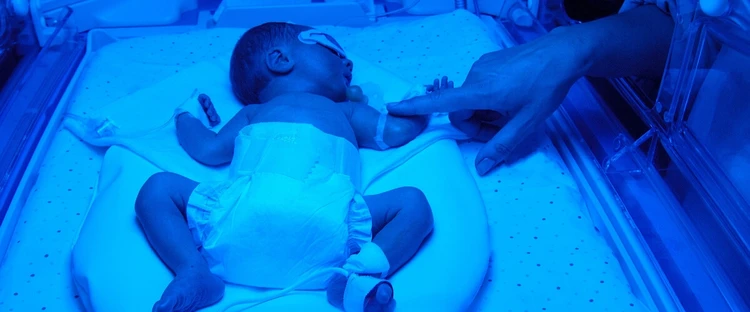 ¿Cuánto tiempo permanecen los bebés prematuros en la UCIN?